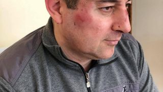 Russia: Activist Attacked in Dagestan Ongoing Violent Harassment of Leading Rights Group